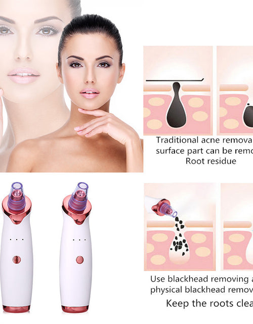 Load image into Gallery viewer, Blackhead Remover Instrument Black Dot Remover Acne Vacuum Suction Face Clean Black Head Pore Cleaning Beauty Skin Care Tool
